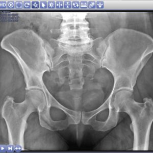 AccuVueCloud - Cloud Pacs